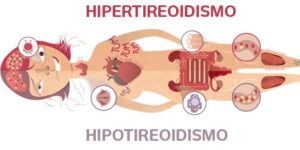 Como Tratar o Hipo e Hipertireoidismo