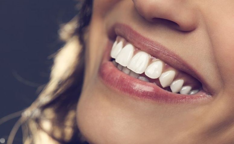 formas de clarear os dentes em casa
