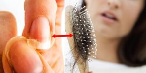 como acabar com a queda de cabelo e unhas fracas