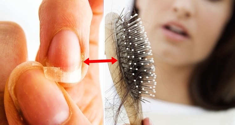 como acabar com a queda de cabelo e unhas fracas