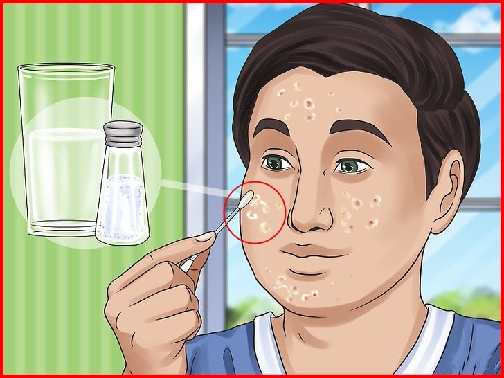 truque caseiro para eliminar cravos e limpar a pele