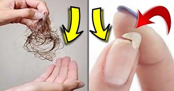 unhas fracas e perda de cabelo