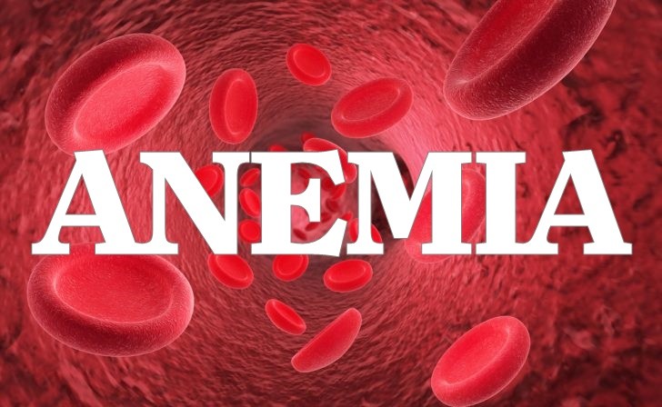 anemia 1