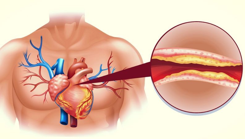 alimentos com alto teor de colesterol