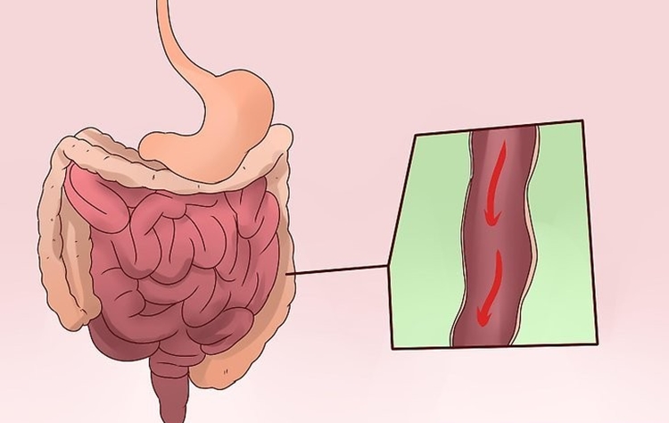 combater vermes intestinais