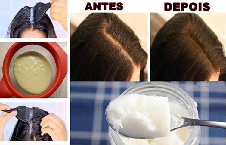 perda de cabelo