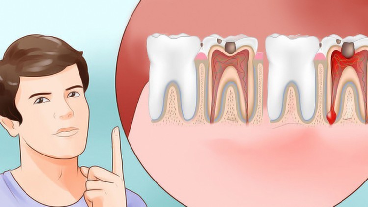 Dor de Dente
