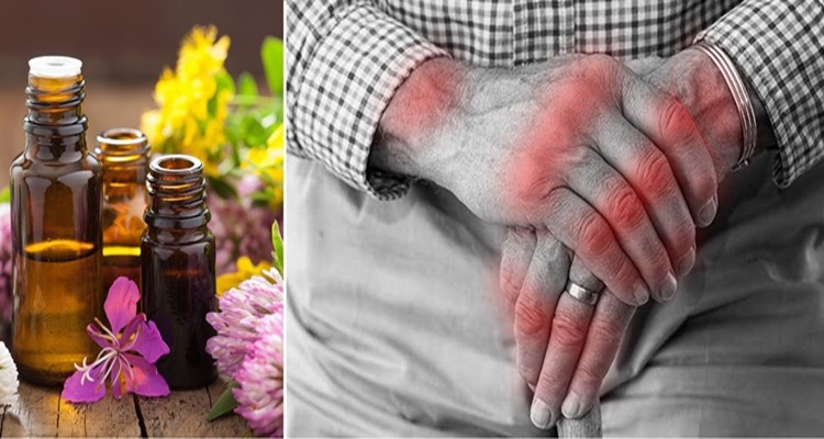melhores oleos essenciais para tratar artrite
