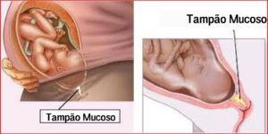 tampao mucosoTampão Mucoso