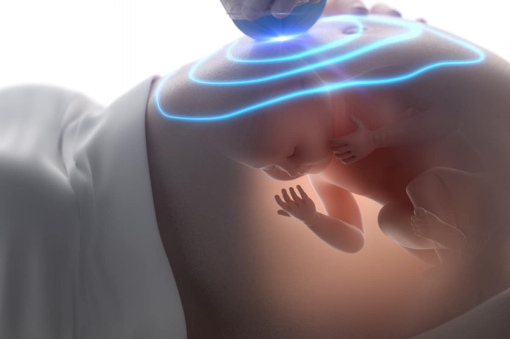 Ultrassom Morfológico: Quando Fazer? Ultrassom Morfológico: Como é?