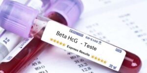 beta HCG quantitativo