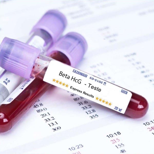 beta HCG quantitativo