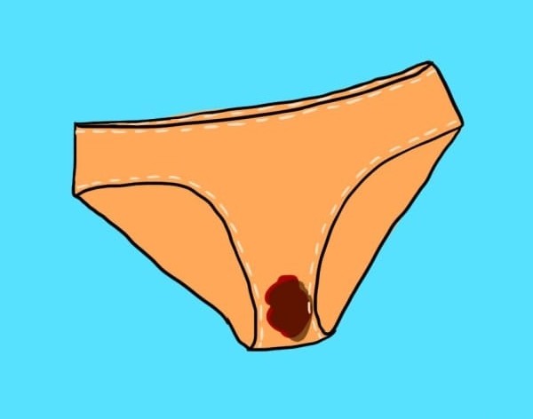 corrimento vaginal sangrento ou marrom