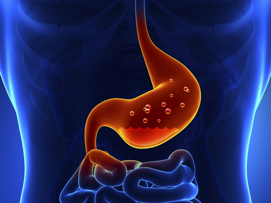 maneiras de tratar o baixo ácido estomacal