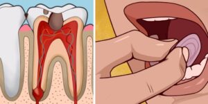 remedios caseiros para dor de dente