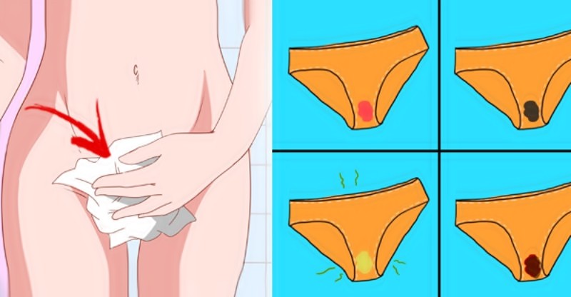 tipos de corrimento vaginal e o que eles dizem sobre sua saude