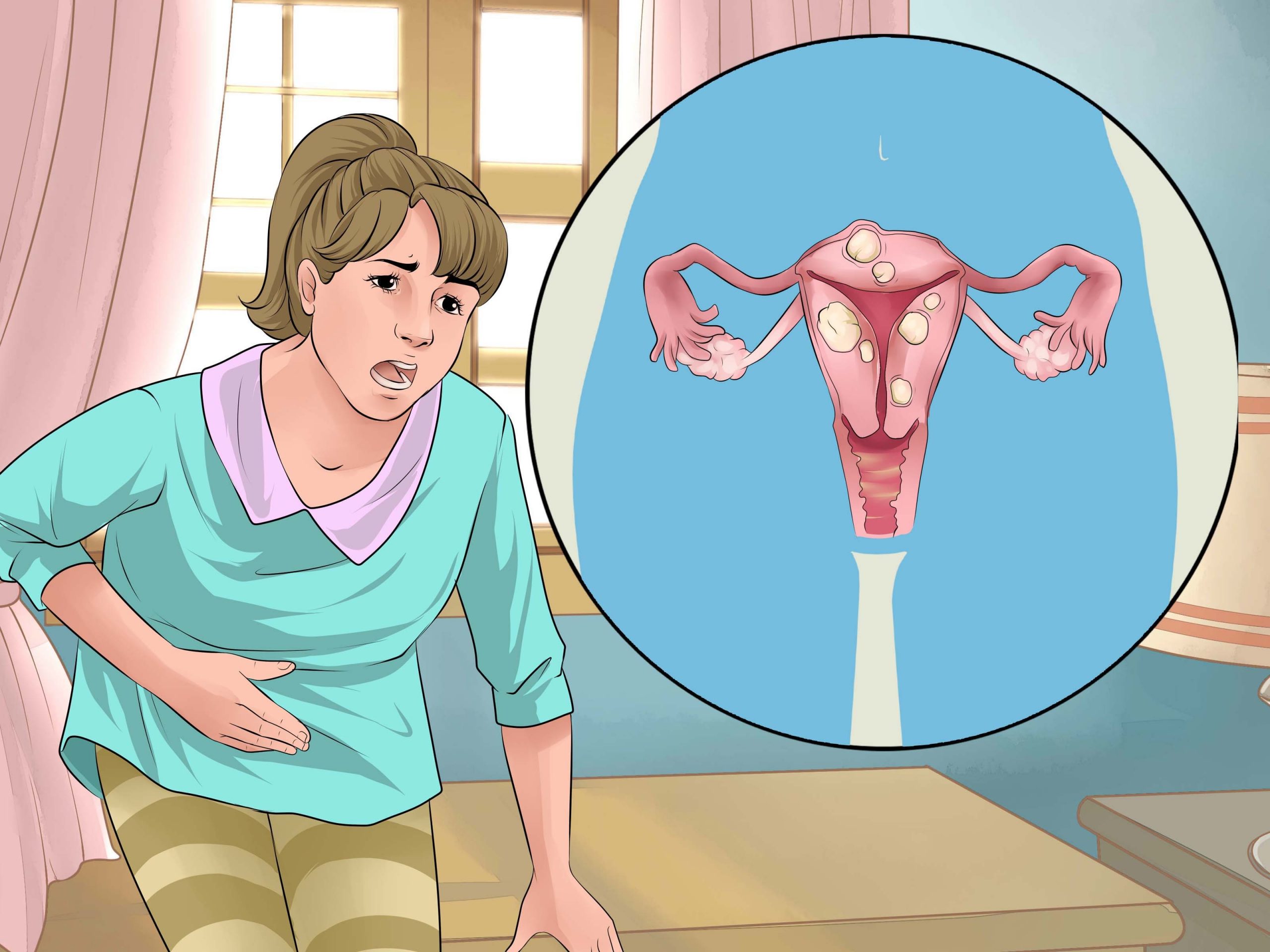 tratamento para menstruacao irregular