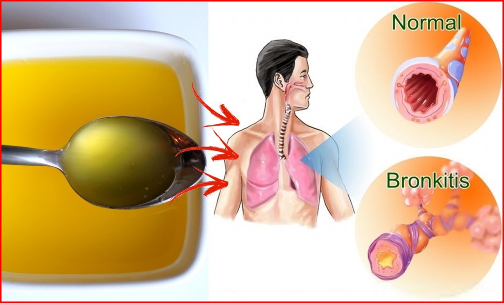 banha de galinha para tratar bronquite