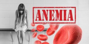 anemia