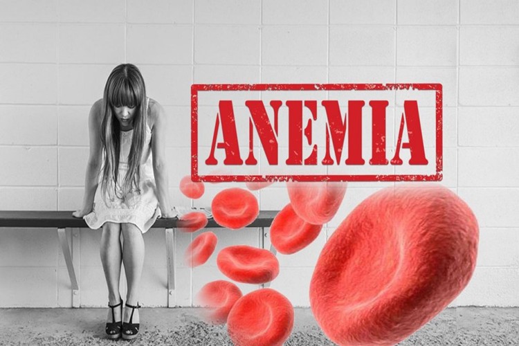 anemia