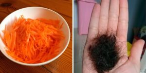 remédios para tratar a queda de cabelo