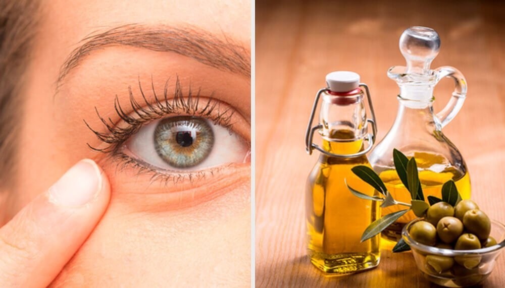 Remédios Naturais Para Aliviar a Inflamação dos Olhos