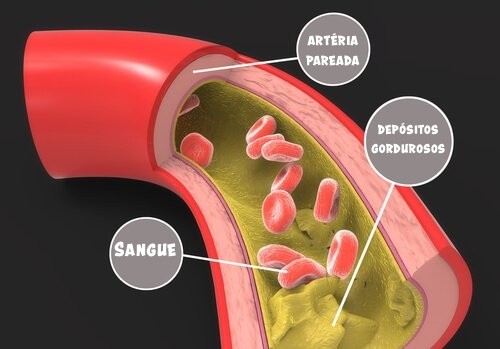 medicamentos para o tratamento de colesterol alto