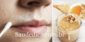 mel e limão para eliminar pelos faciais