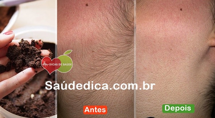 maneiras de eliminar pelos indesejados