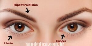 coisas que os olhos dizem sobre sua saúde