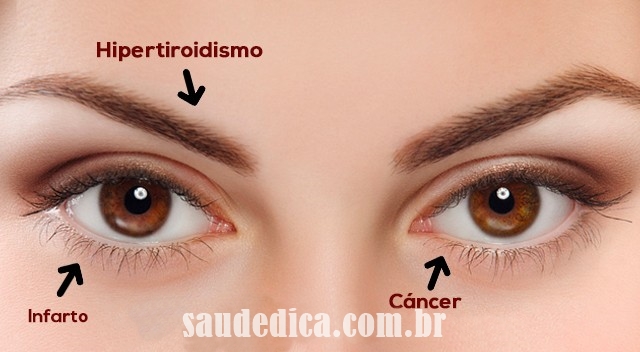 coisas que os olhos dizem sobre sua saúde