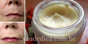 creme caseiro para eliminar todas as rugas