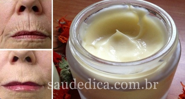 creme caseiro para eliminar todas as rugas