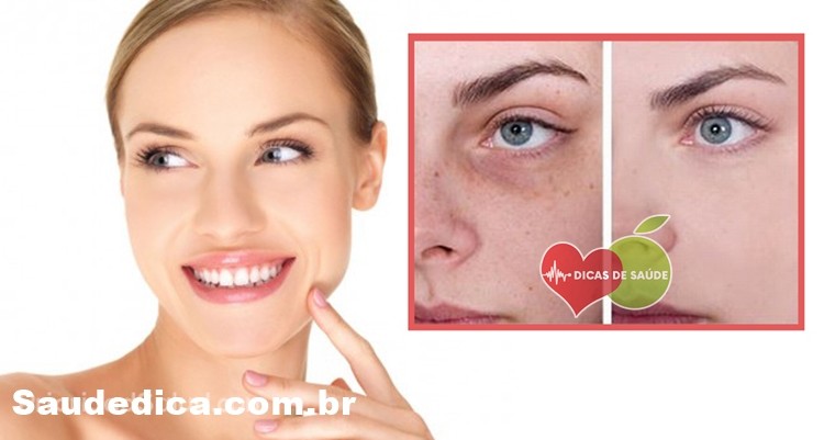 remover manchas remover manchas