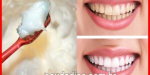 bicarbonato para eliminar o tártaro e clarear os dentes