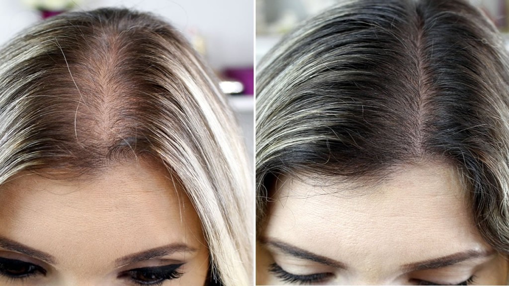 Perda de Cabelo Perda de Cabelo