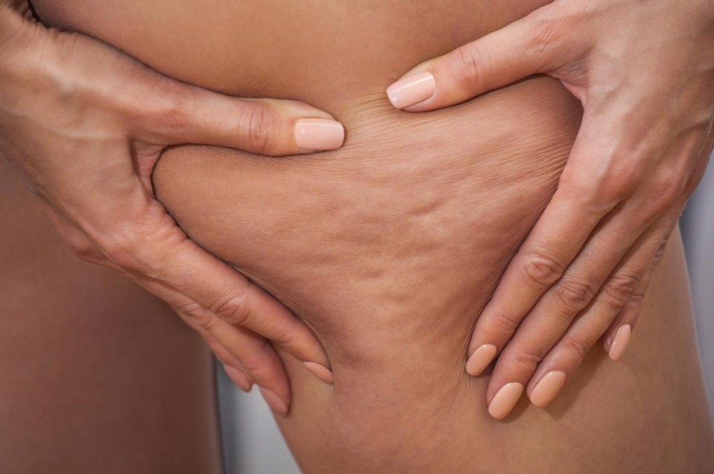 Ingredientes para eliminar celulite Ingredientes para eliminar celulite