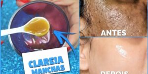 batata e limão para eliminar rugas e cicatrizes de acne