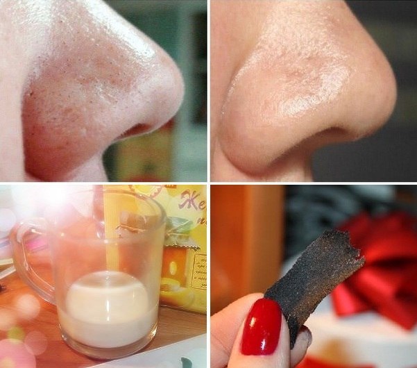 máscaras simples para remover cravos no nariz