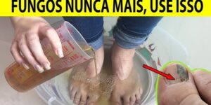 receita caseira para eliminar fungos das unhas