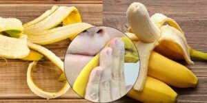 máscara de banana para eliminar acne