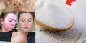 maneiras eficazes de usar o açúcar nos cuidados de beleza