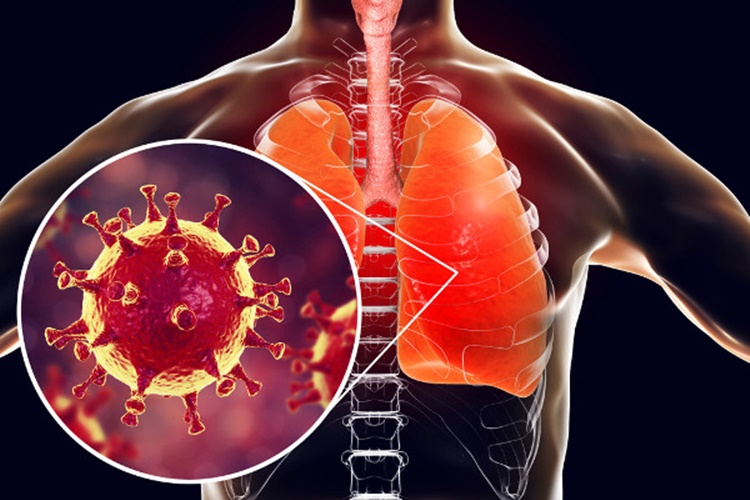 coronavírus afeta os pulmões
