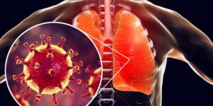 coronavírus afeta os pulmões
