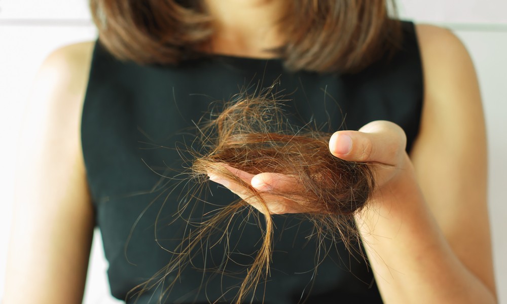 perda de cabelo é um sintoma de problemas na tireoide