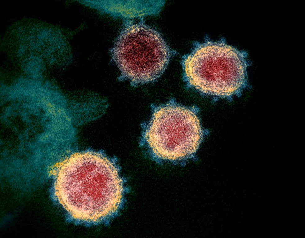 o que e o virus da influenza h3n2