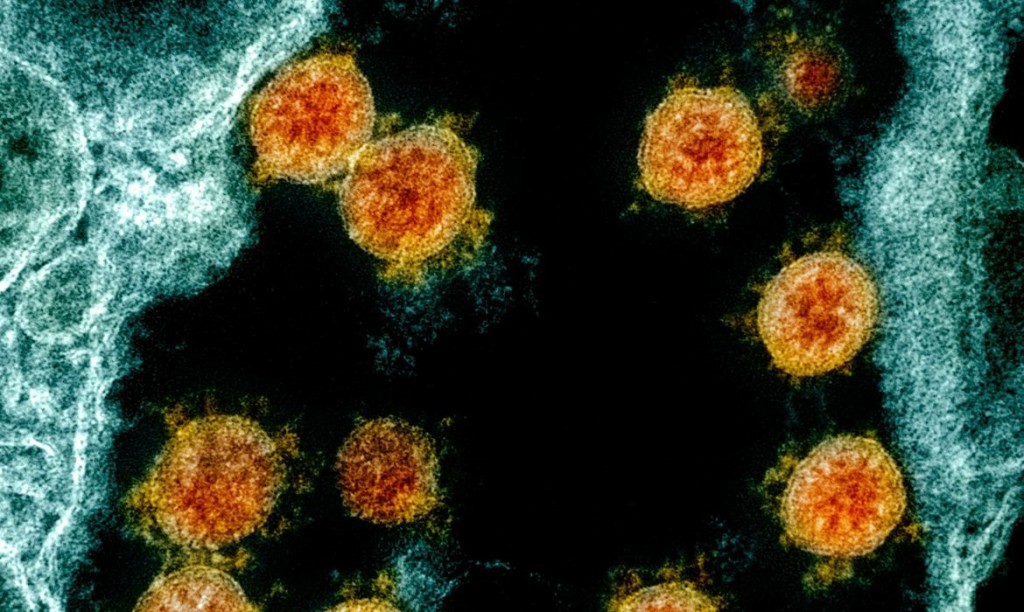 sinais e sintomas do vírus da gripe h3n2