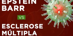vírus epstein barr vs esclerose multipla