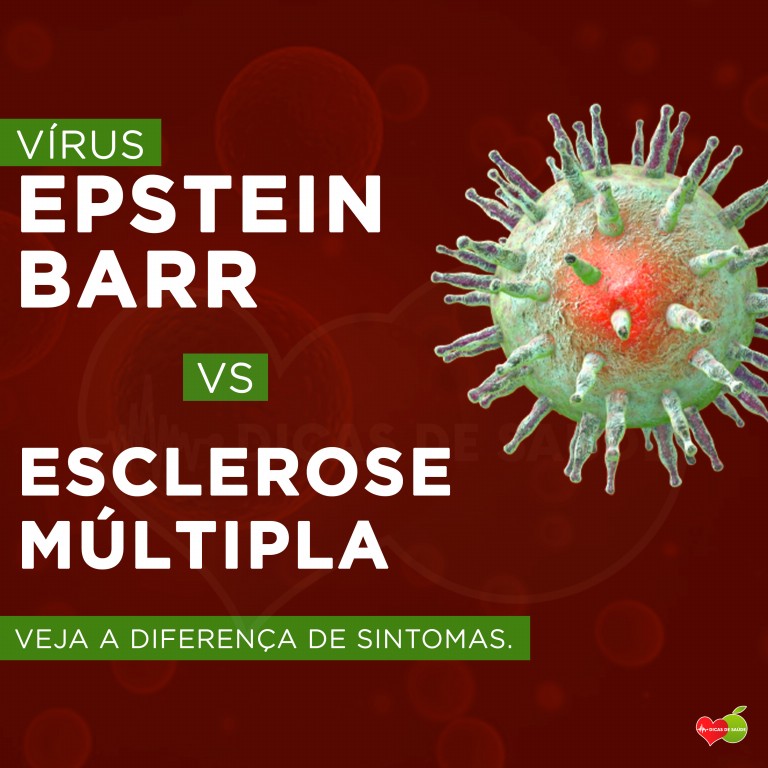 vírus epstein barr vs esclerose multipla