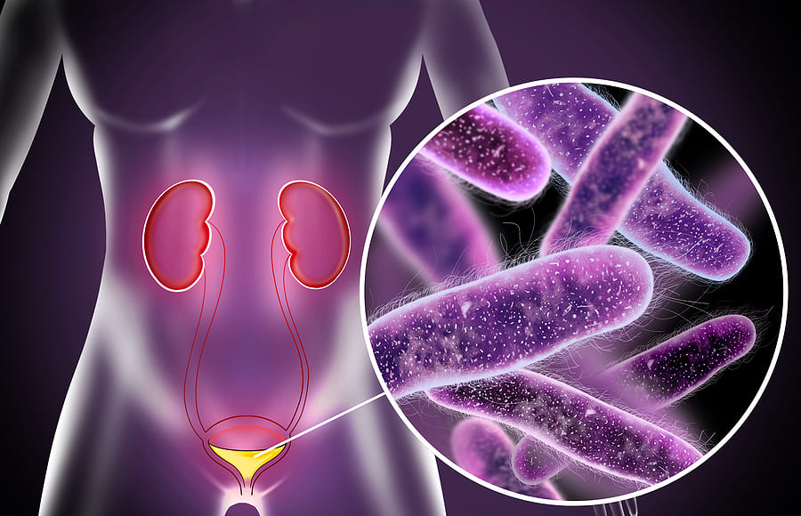 Flora bacteriana: o que é, aumentada, discreta